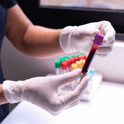 Hands holding a blood sample from Fios Genomics biobank data blog